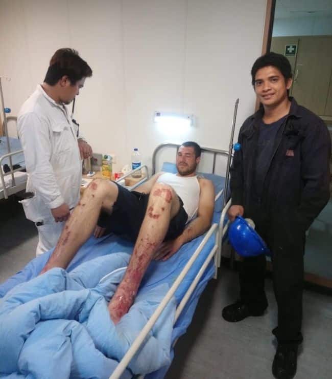 Yevgeniy Nikolov se rétablit à l'hôpital (Crédit : MTWTU)